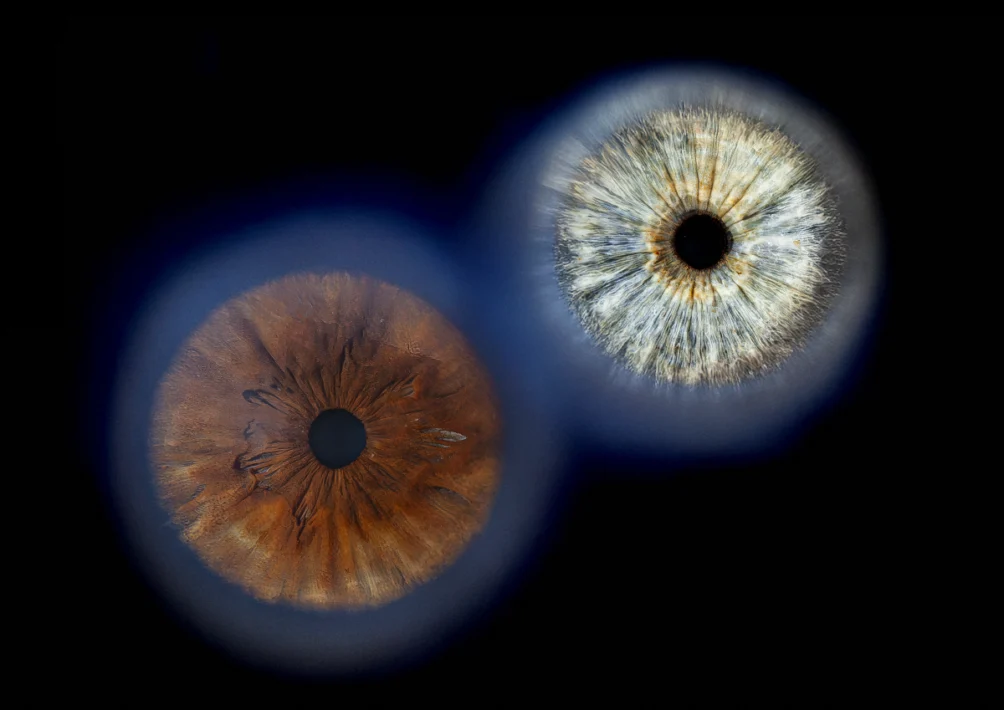 Iris-Fotografie
